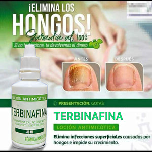GOTAS DE TERBINAFINA PARA ELIMINAR LOS HONGOS