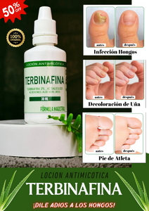 GOTAS DE TERBINAFINA PARA ELIMINAR LOS HONGOS
