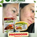 JABÓN DE CÚRCUMA 100% NATURAL